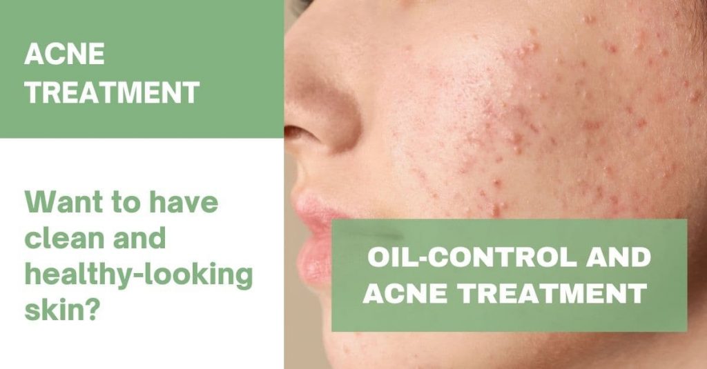 acne treatment for healthy looking skin